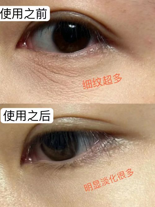？2025眼霜测评总结分享干货！k8凯发全站什么眼霜去皱效果好(图2)
